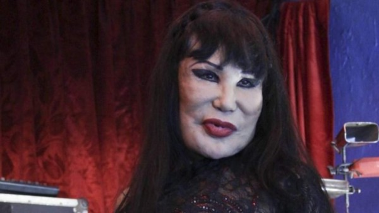 May dio la exclusiva al programa 'Un nuevo día', de la cadena Telemundo. El cirujano de la estrella dio a conocer detalles de las operaciones que le practicará.