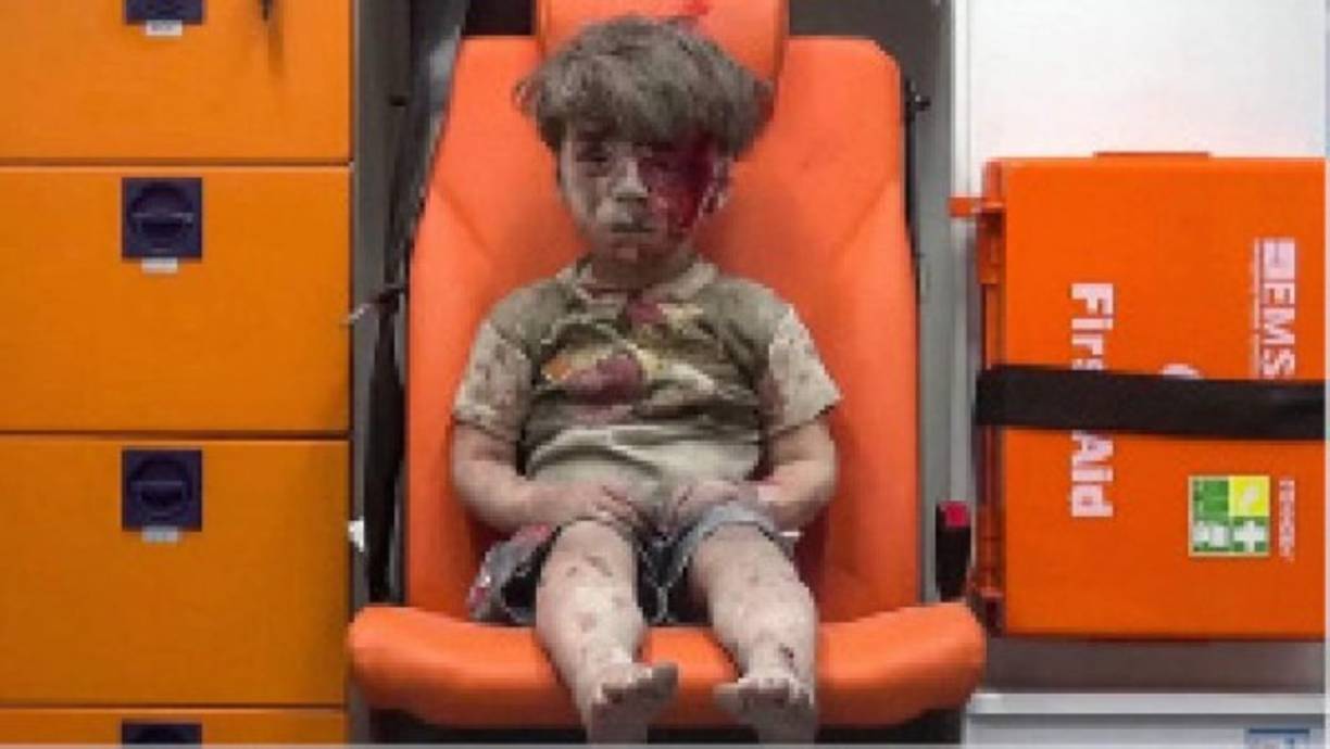 Siria. El rostro de la guerra. Omran, un niño sirio de 5 años que sobrevivió a un ataque aéreo de la aviación rusa o del régimen del presidente Bashar al Asad conmovió al mundo. El pequeño fue captado en una silla de color naranja de una ambulancia mientras esperaba la llegada de personal sanitario. Su rostro ensangrentado impactó a millones de personas.