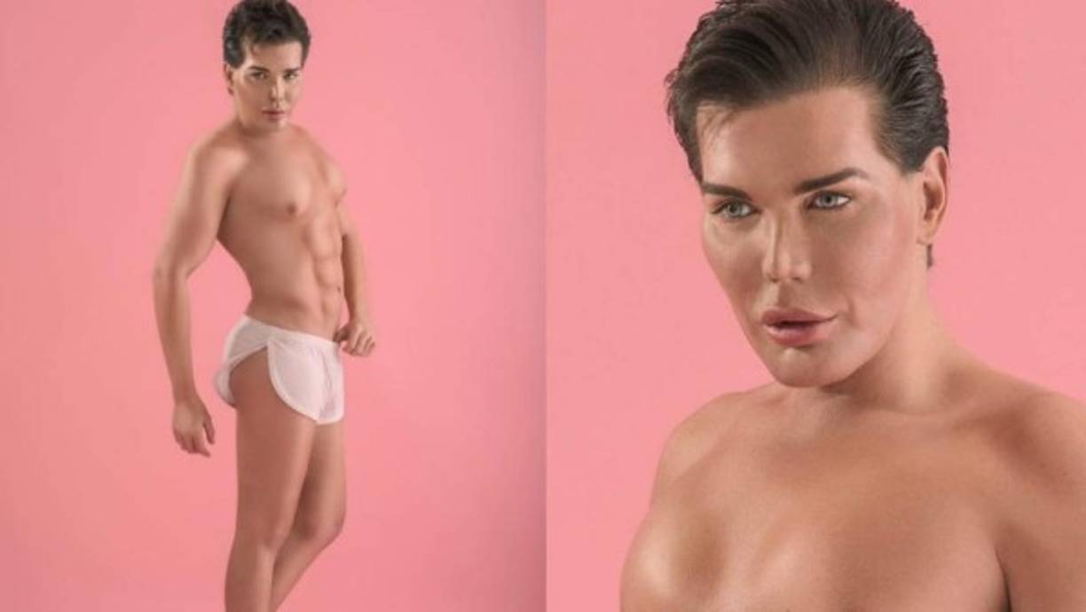 El brasileño se ha realizado más de 40 operaciones y gastado más de 350.000 euros en todo el proceso quirúrgico para lograr parecerse a Ken.