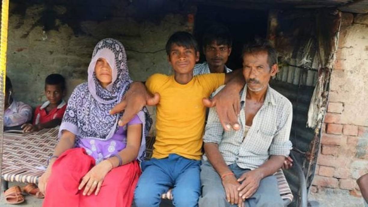 Los residentes de Uttar Pradesh lo llaman 'El Diablo', pues creen que la anormalidad de sus manos se debe a alguna maldición. Fuente e imagen: Infobae