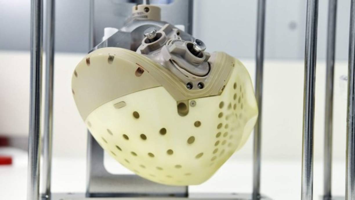 La bioprótesis, que pesa 900 gramos y es alimentada por baterías de ion de litio, se pondrá a la venta durante el segundo trimestre de 2021. Fotos AFP