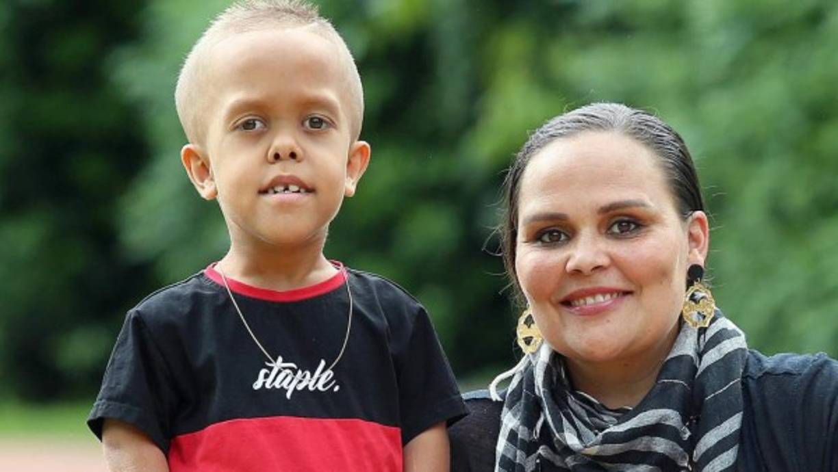 La familia de Quaden Bayles, el niño australiano con acondroplasia que se volvió viral luego de que su madre publicó un video en redes sociales el buylling que sufría el pequeño en la escuela, informaron que rechazaron USD 474.000 que una iniciativa online había recaudado para que visitara Disneylandia y optó por donar ese dinero a diversas ONGs que luchan contra el acoso escolar.