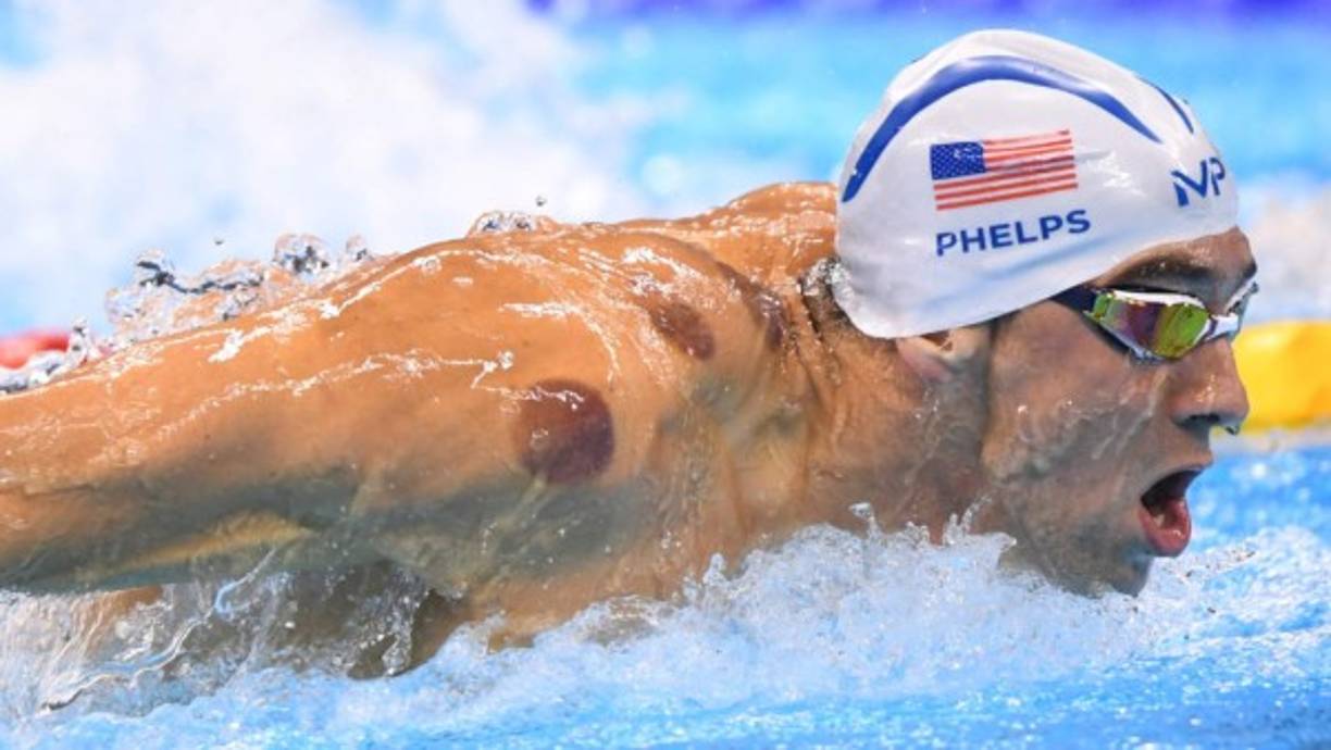 Michael Phelps: <br/>El nadador que ha roto records padece el síndrome de Marfan.