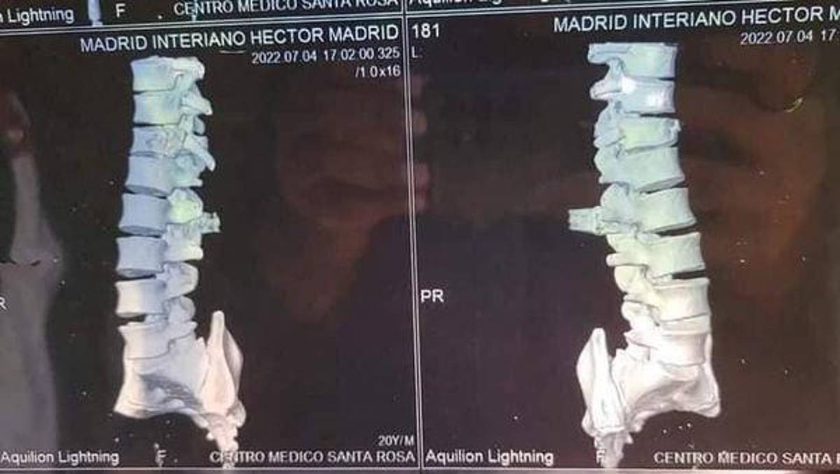 La deuda era de 800 lempiras aproximadamente. Los días pasaron y el hondureño no había podido honrar su compromiso, por lo que, de acuerdo con sus familiares, fue atacado a balazos junto a su padre en la comunidad de El Pedernal, La Jigua, Copán.