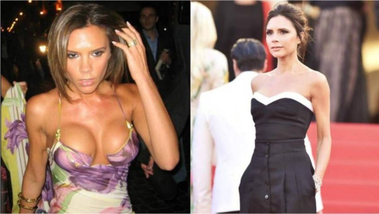 Victoria Beckam ha pasado varias veces por el quirófano.