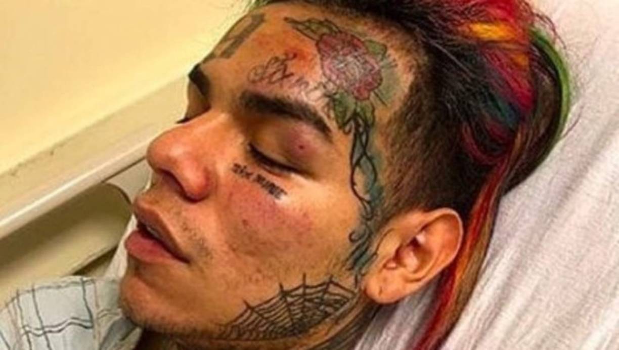 Hace algunoos tres meses diferentes medios de comunicación reportaron el secuestro de Tekashi en el que sufrió un robo de unos 750 mil dólares en joyería y efectivo. El rapero pasó unos días en el hospital por golpes en su rostro.<br/>