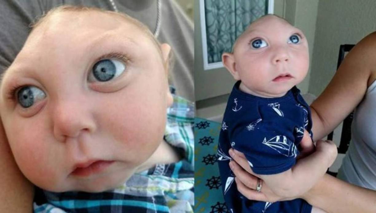 Brittany acudió a realizarse una ecografía para saber cómo iba su embarazo. Al ser evaluada, los médicos le indicaron que su bebé sólo tenía una parte del cráneo y cerebro, así que la recomendación era abortar.