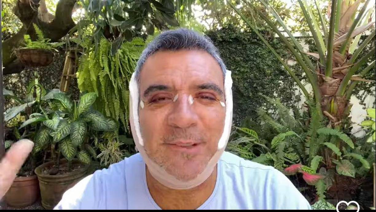 Unas horas después de haber salido con éxito de su cirugía, el que fuera presentador del reality show de Telemundo La casa de los famosos publicó un video a través de su perfil de Instagram, donde está a punto de alcanzar el medio millón de seguidores, en el que se mostró por primera vez a cámara tras la operación.