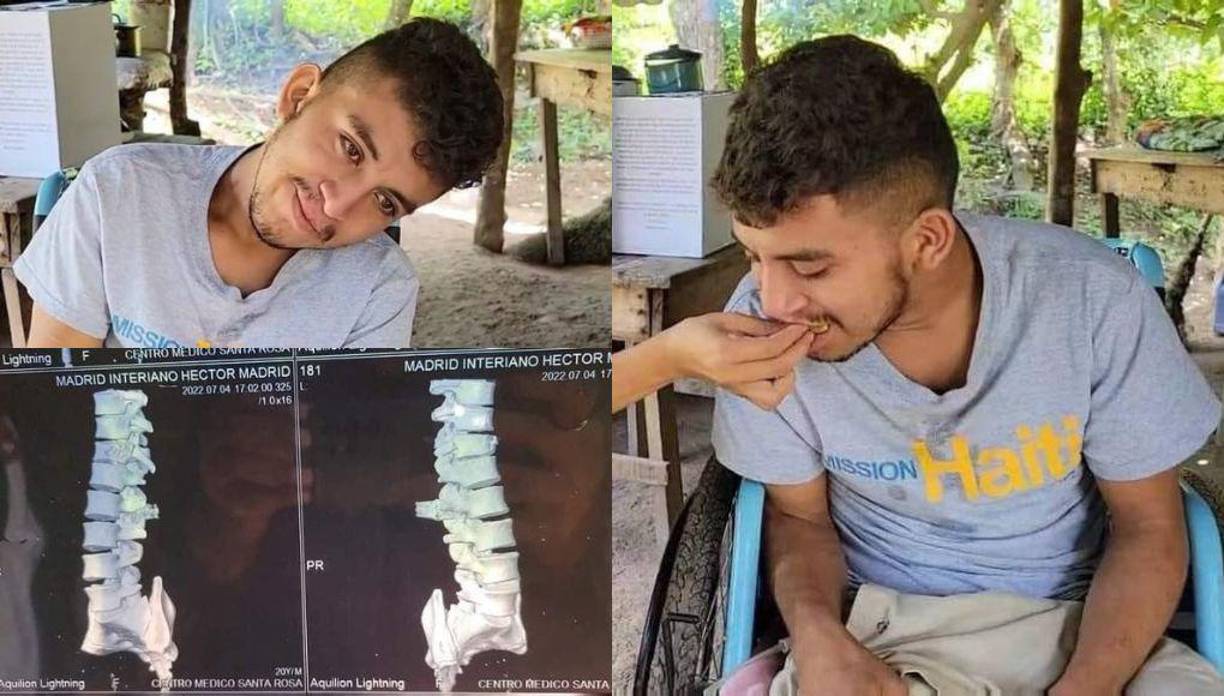 “A mí me balearon por 800 lempiras y yo estaba a horas de ir a pagar, el siguiente día iba a pagar”, asegura Héctor Josué Madrid, de apenas 20 años de edad.