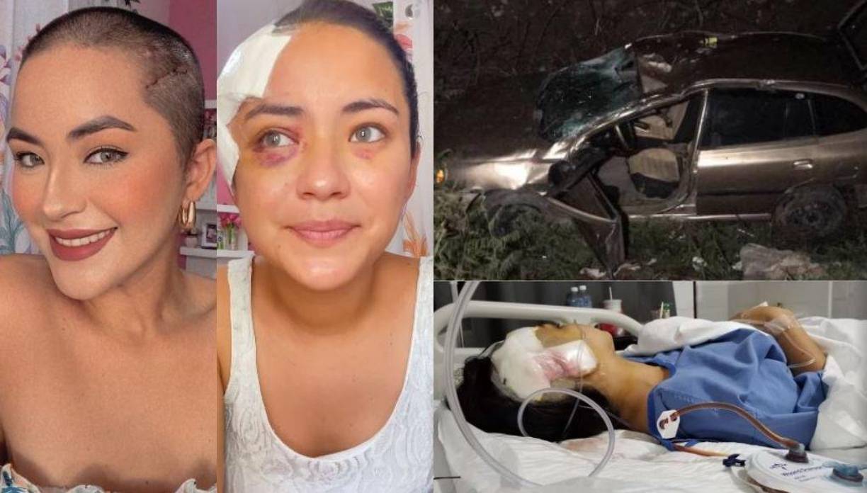 Iris Portillo, modelo y periodista, sufrió un accidente de tránsito cerca del mall Las Américas de Choloma, Cortés el pasado 29 de junio. La joven perdió el control de su vehículo y cayó en una hondonada.
