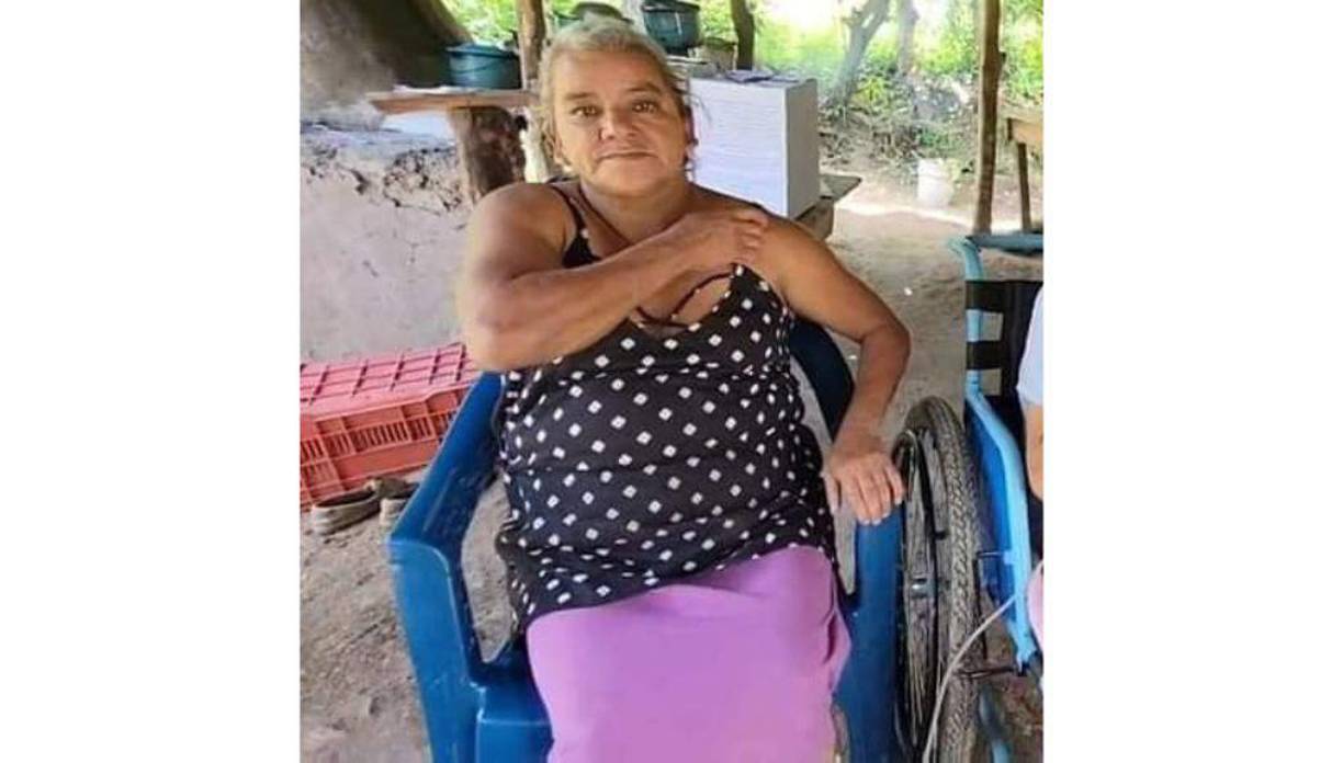 La madre de Héctor mostró las radiografías de la columna de su hijo y comentó cuán difícil ha sido para ella mirar a su hijo con limitaciones para moverse.