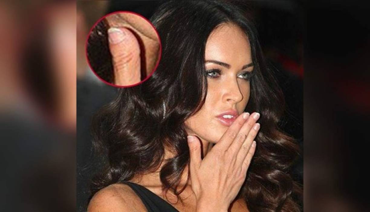 Megan Fox<br/>Sufre braquidactilia, una malformación que impide que los dedos se desarrollen de manera normal. La actriz nació con esta anomalía que hace que los dedos pulgares de las manos sean mucho más cortos y anchos de lo normal. A pesar de todo esto, a la protagonista de 'Transformers' no le ha ido nada mal en su carrera y salvo por esta pequeña malformación, Fox tiene un tipazo envidiable.