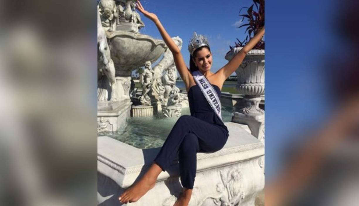 La Miss Universo, Paulina Vega, tiene un defecto en uno de los dedos de su pie. Ella no tiene uña y su dedo está más pequeño de lo normal. Pese a su defecto, la beldad no se averguenza.