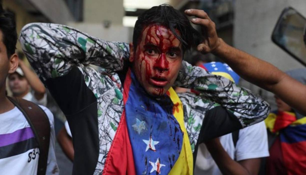 Los violentos enfrentamientos entre las Fuerzas de Seguridad venezolanas y los manifestantes opositores en Caracas han dejado al menos 16 muertos, informaron este jueves medios locales.