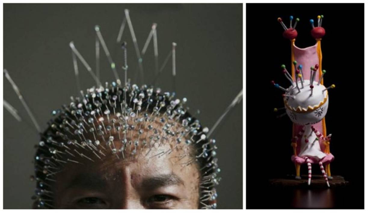 Belonefilia: Está relacionada con la excitación, el placer, búsqueda y alcance del orgasmo a través de los pinchazos con agujas. Aquí la persona podría tener fantasías con agujas, al igual que podría llevarlas a la realidad para pincharse con el mero objetivo de satisfacerse sexualmente.