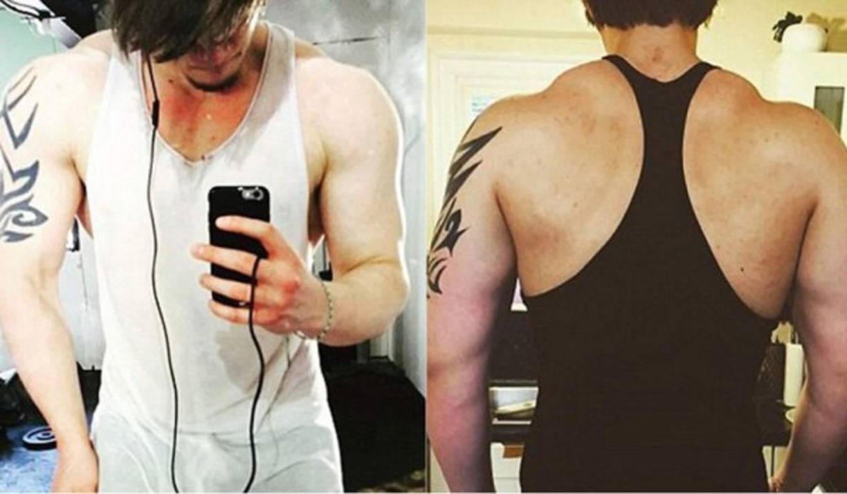 Andrej Gajdos, de apenas 19 años, falleció al estallarle la vena aorta por consumo excesivo de esteroides.