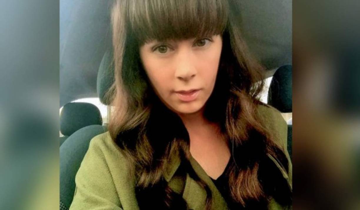 Y es que para su horror, Amanda despertó inflamada y con pedazos de su piel despellejada un día despues de tatuarse las cejas.