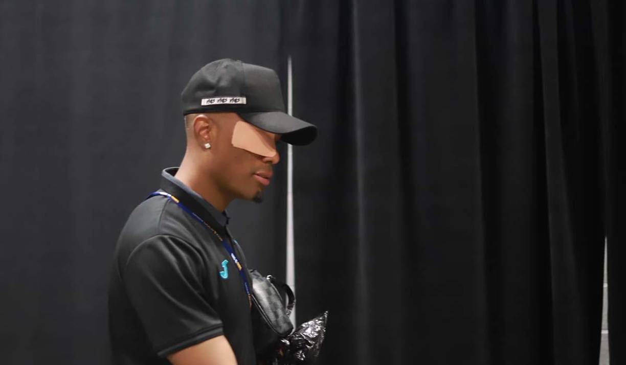 Deybi Flores recibió un golpe y terminó con un vendaje en su ojo izquierdo.