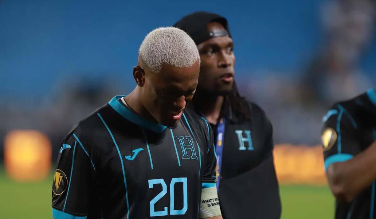 Deybi Flores terminó el partido con un problema en su ojo izquierdo.