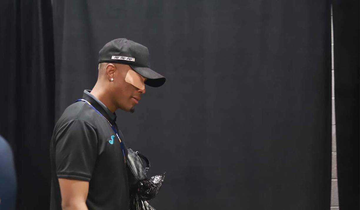 A Deybi Flores se le vio en la zona mixta con una cinta o venda en el ojo izquierdo. 