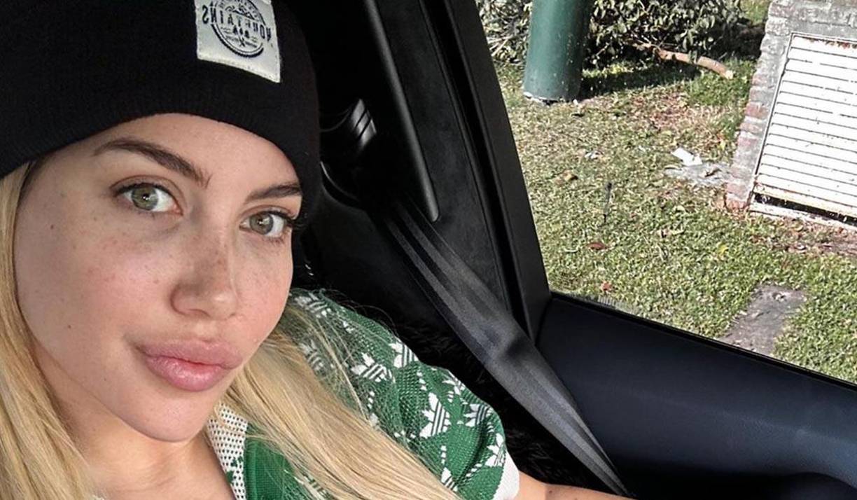 Luego de sufrir fuertes dolores abdominales, Wanda fue internada hace unos días atrás en el hospital Los Arcos. 