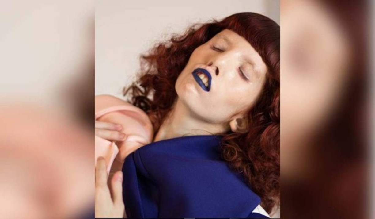 Nacida con un trastorno cromosómico raro, Caitin Stickels, fue descubierta por Knight por su cuenta de Instagram, donde tiene más de 9,000 seguidores.