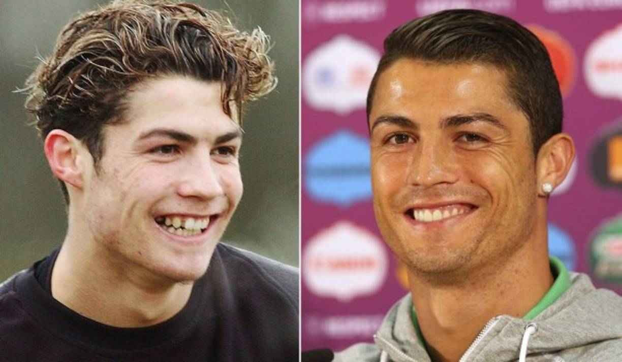 El rostro de Cristiano Ronaldo ha evolucionado a lo largo de los años, por lo que en diálogo con el sitio colombiano Kien y Ke, el cirujano Ernesto Barbosa detalló cuáles fueron los procedimientos a los que pudo haberse sometido CR7.