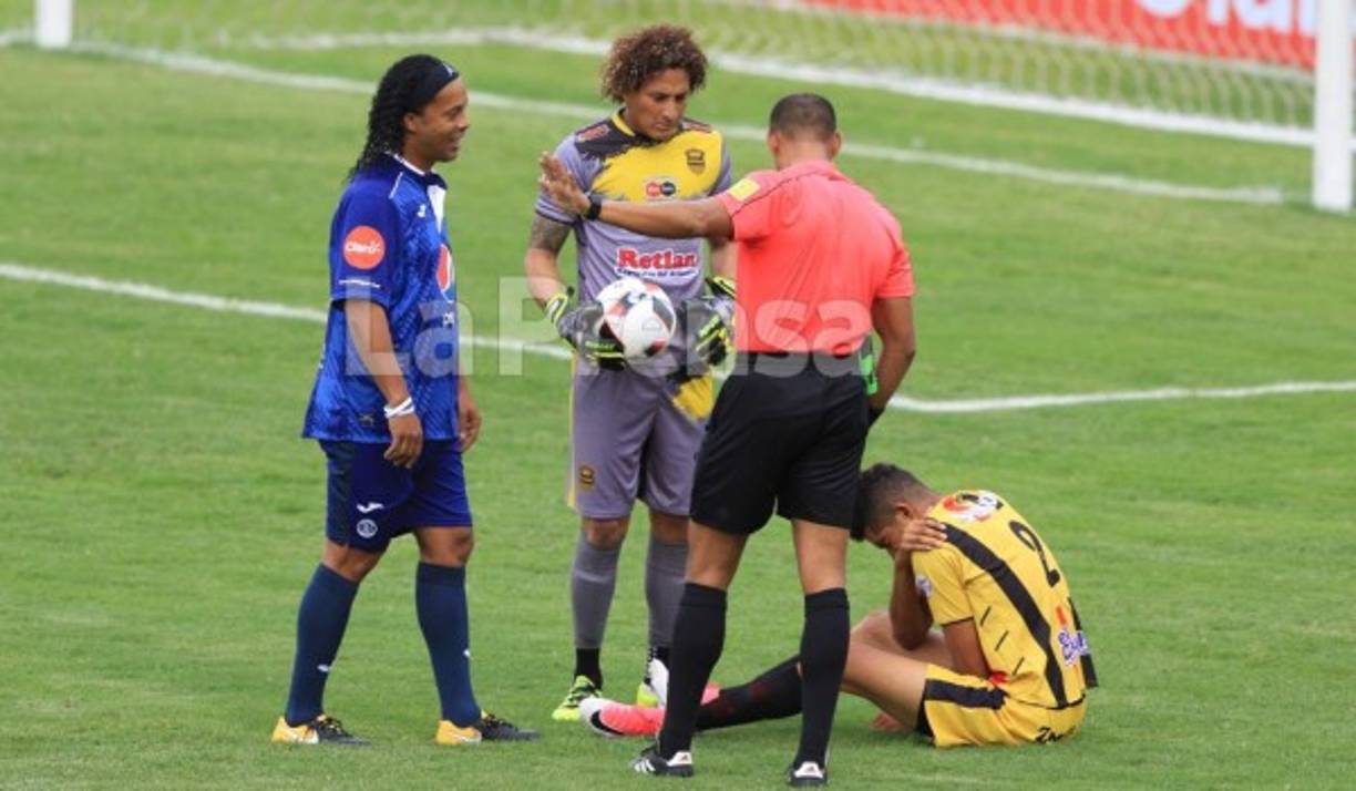 Getsel Montes se lesionó en el Partido por la Paz en donde brilló Ronaldinho Gaucho, no se descarta que en el Real España fichen a un zaguero. El zaguero era su nueva contratación y tendrá que ser operado.