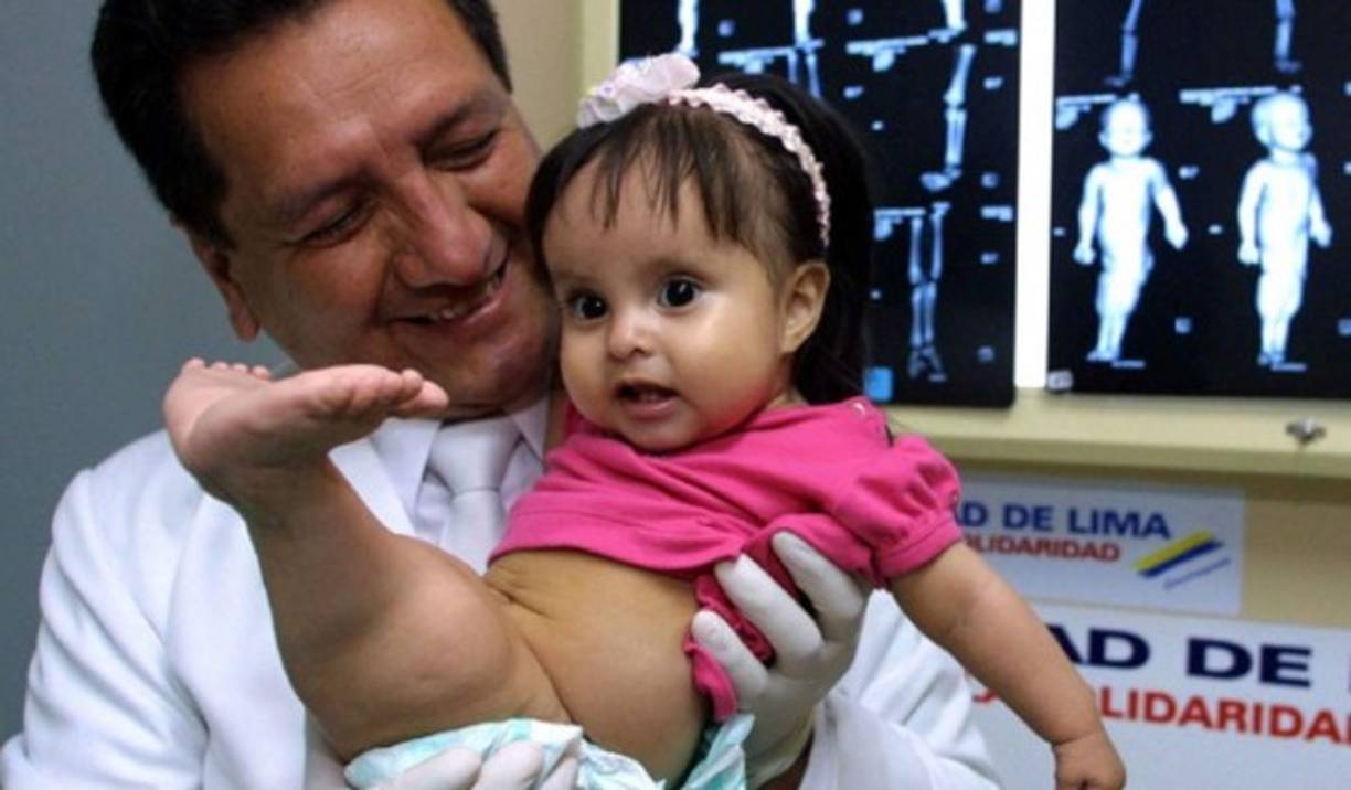 El caso y las imágenes de la malformación que padecía la pequeña Milagros se viralizaron rápidamente por Internet.