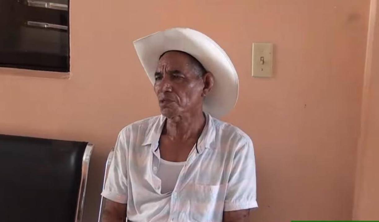 Don German reconoció que sí la lesionó pero denunció que en el pasado su joven amante también lo maltrataba. 