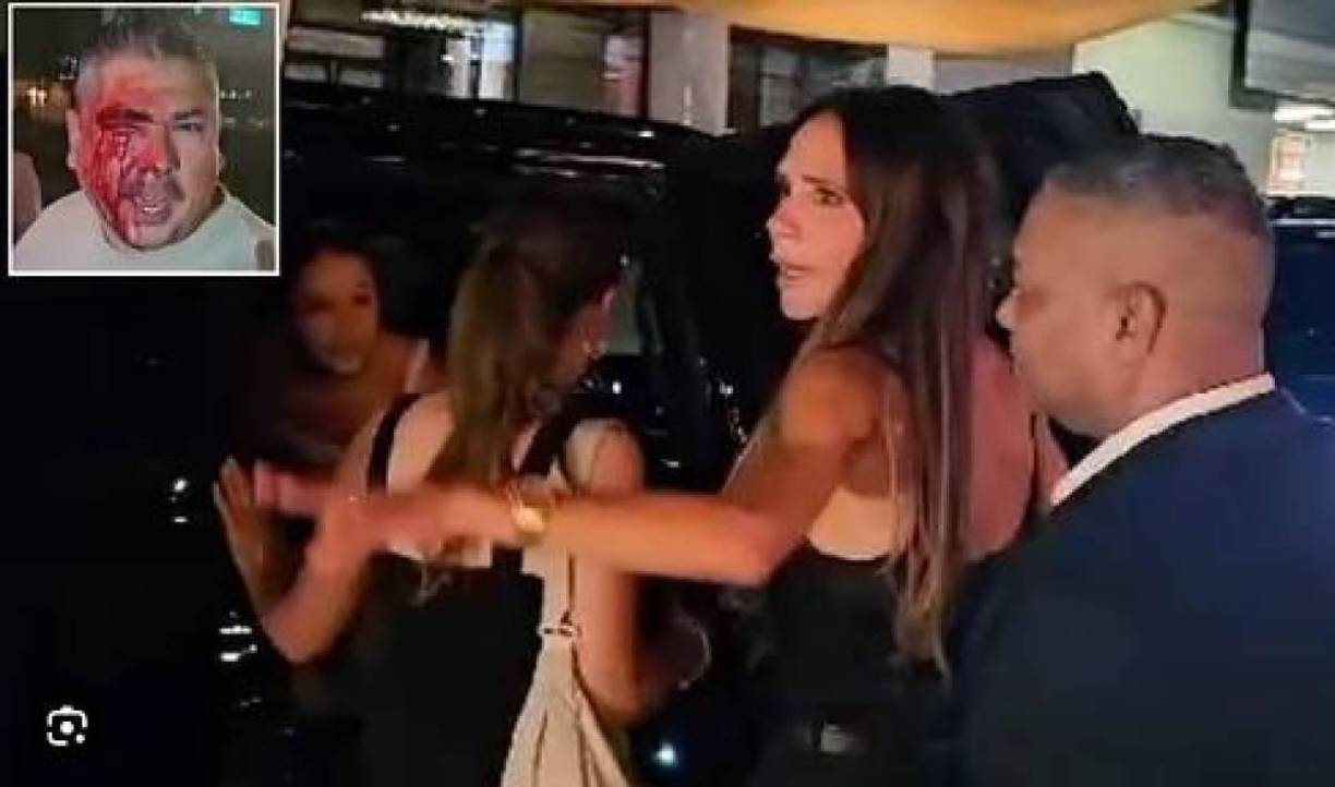 El comensal afirmó que fue agredido hasta sangrar de su ojo derecho por la seguridad después de que su familia intentara tomar una postal en el cumpleaños 21 de su hija. 