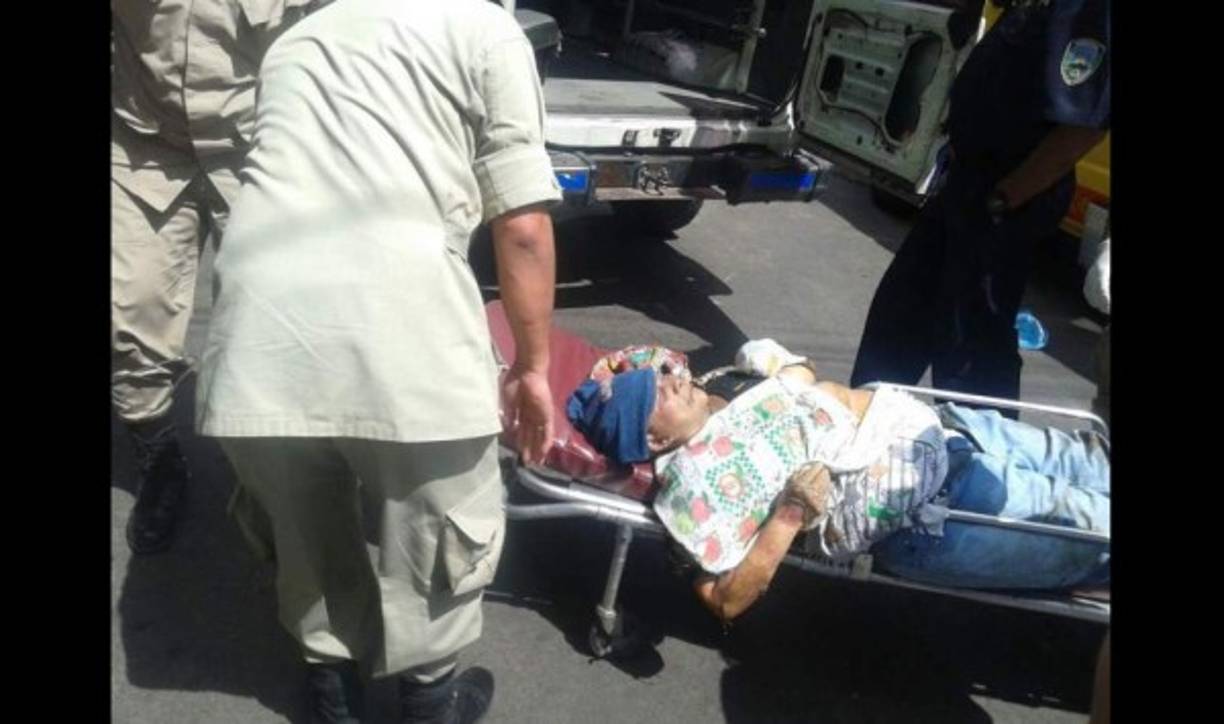 Entre los quemados hay personas de la tercera edad y menores de edad.