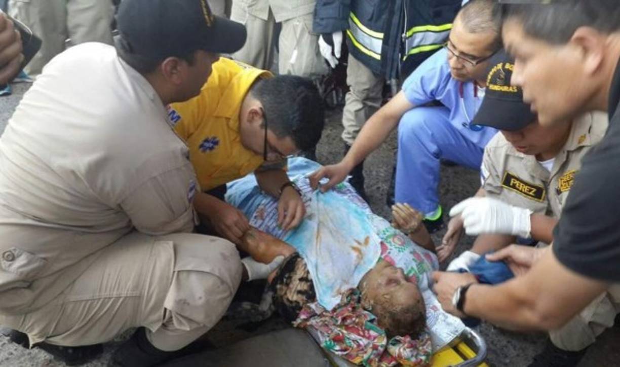 El Cuerpo de Bomberos asistió a los quemados leves.