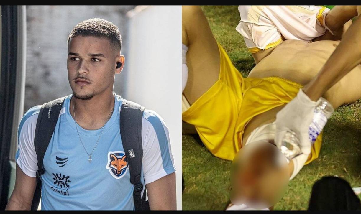 El texto, difundido a través de la cuenta oficial de Instagram de la institución, continuó con un detallado relato: “Después del final del partido contra Central West, nuestro portero Ramon Souza fue cobardemente alcanzado por una bala de goma, llevada a cabo por un oficial de policía. Un acto horrible, increíble y criminal por parte de alguien que debe valorar la seguridad e integridad de las personas, que se encontraban en el estadio Jonas Duarte”.