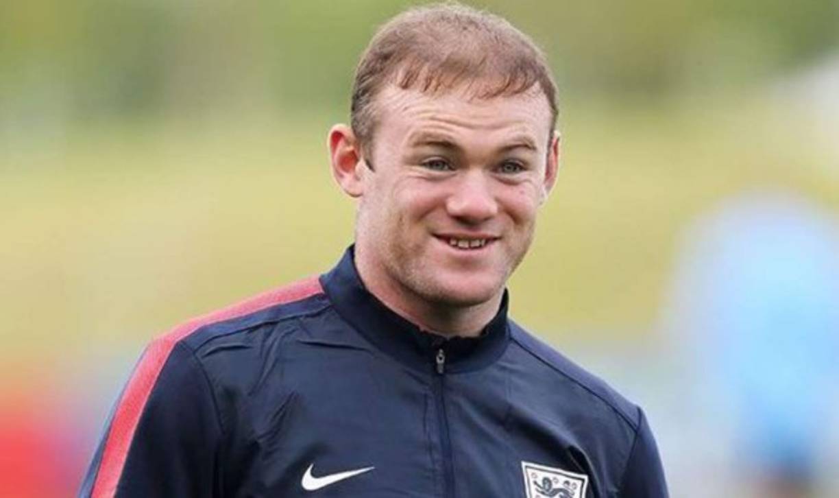 Wayne Rooney. El principal problema del 'bad boy' de la Premier League era su calvicie, con solo 25 años. El jugador del Manchester United se gastó 34.000 euros en un injerto capilar que ha dado sus frutos.