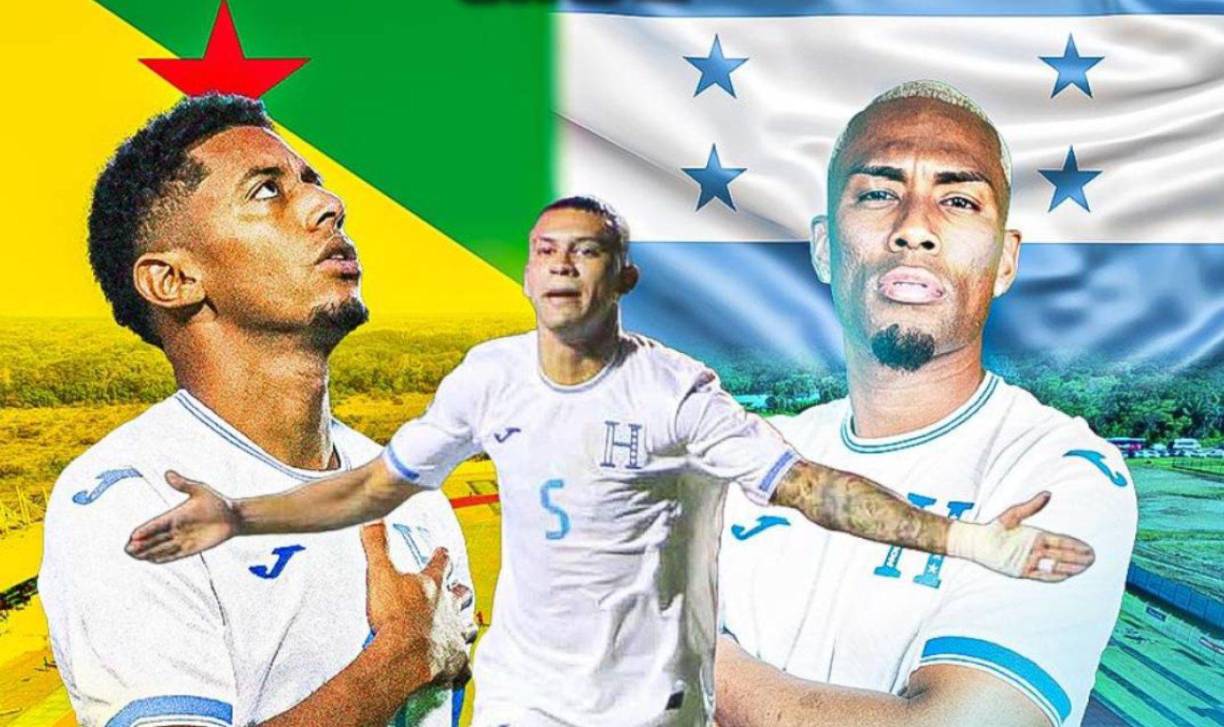 El Honduras vs Guayana Francesa inicia a partir de la 1:30pm, horario hondureño. Se podrá ver por Tigo Sports.