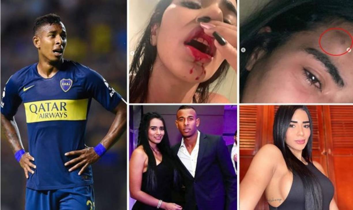 Sebastián Villa, delantero colombiano de Boca Juniors, fue denunciado por su novia Daniela Cortés por violencia de género a través de una publicación en su cuenta de Instagram, en la que lo acusó de “maltratador físico y psicológico” y mostró fotos y videos de las lesiones que le habría provocado el futbolista.