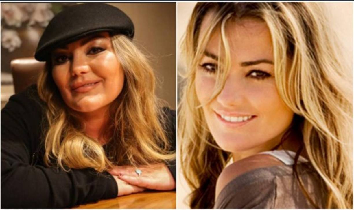 La cantante española Amaia Montero y exvocalista de La Oreja de Van Gogh ha tenido un gran cambio físico con el paso del tiempo. El abuso de las cirugías la han llevado a tener un rostro irreconocible.