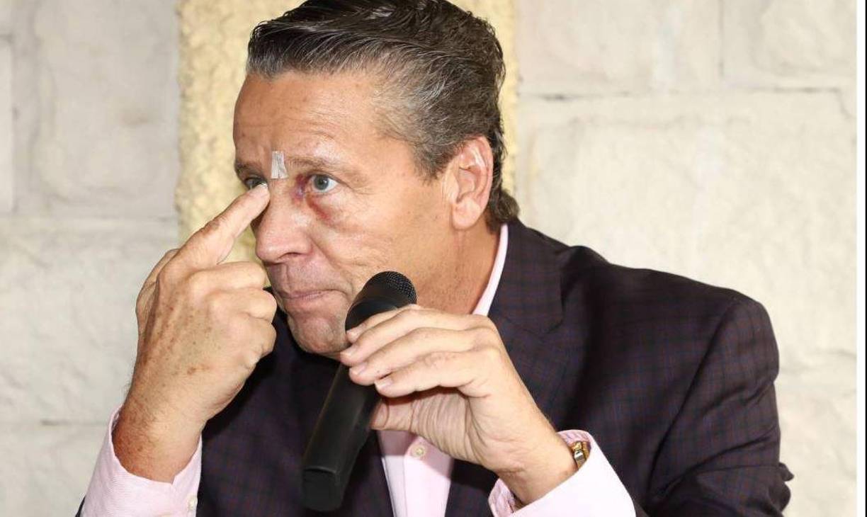 La actriz Diana Golden ganó una demanda contra el también actor Alfrdo Adame por difamación. La estrella de telenovelas aseguró que diversas declaraciones de Adame afectaron su salud mental.