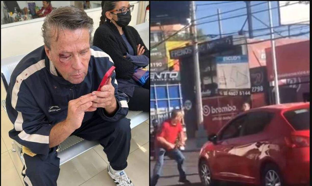 “Ahí ya fue donde verdaderamente me enchilé y me bajé, saqué mi tubo y le di cuatro (golpes), que son cuando está él adelante del coche rojo, donde yo le estoy dando los tubazos, y luego llega otro cuate y me dice que me calme porque ya lo tumbé”.