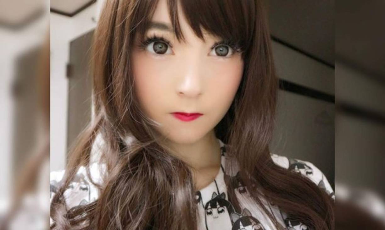 La vanidad por poco lleva a la influencer Venus Palermo a la tumba, quien por desear adelgazar aun más se quitó 120 centímetros de intestino.