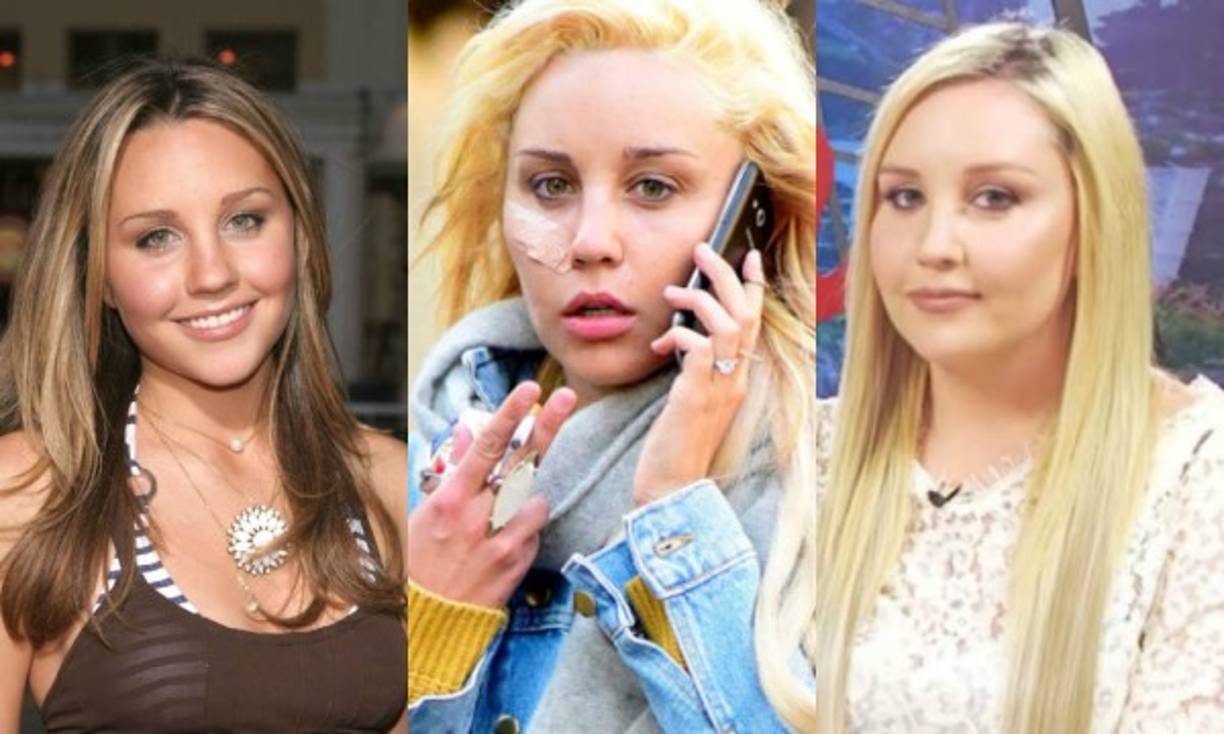 Amanda Bynes . Debutó a las 10 años en series infantiles y para los 13 ya tenía su propio programa, 'The Amanda Show' (1999), y ganó premios y reconocimientos por su trabajo en el cine de comedia.<br/><br/>En 2013 a los 27 años pasó seis meses en rehabilitación y luego en una clínica psiquiátrica por su comportamiento errático.<br/><br/>Para el siguiente año volvió a manejar alcoholizada y fue internada tras acusar a su padre de abuso sexual.<br/><br/>Actualmente asegura estar rehabilitada y planea volver a la pantalla.