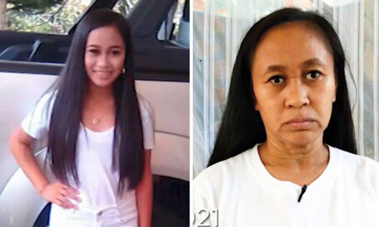 La joven relató a la cadena filipina GMA que sus padecimientos iniciaron con un sarpullido que apareció en todo su cuerpo. A los pocos días notó que su aspecto que empezó a cambiar de forma alarmante tras la aparición de arrugas en su cara, cuellos, brazos y estómago.