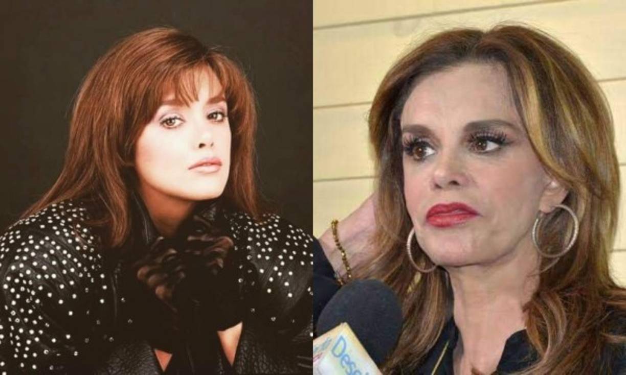 Lucía Méndez fue una de las bellezas más cotizadas en su tiempo, pero con el paso de los años ha recurrido a varios procedimientos estéticos para poder detener los estragos del tiempo.