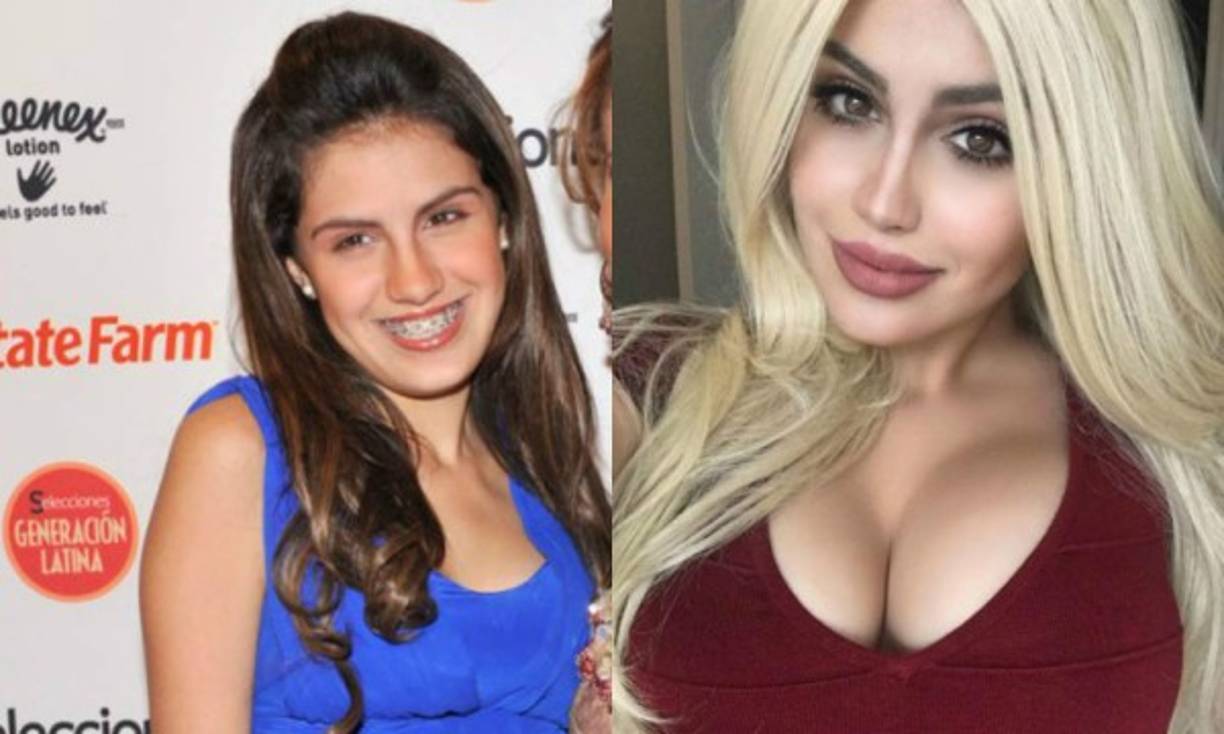 Myrka le confesó a Raúl de Molina que Alexa solo se había hecho dos simples procedimientos, uno para eliminar las ojeras y el otro para aumentar el volumen de sus labios, algo que se “hace todo el mundo”.<br/>