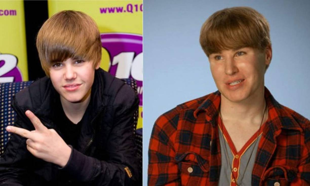 Este chico de 33 años llamado Toby Sheldon se gastó casi 90.000 euros en cirugía plástica. Pasó por liposucciones, implantes de cabello, cirugías de ojos, nariz, pómulos y boca. Su cuerpo sin vida fue encontrado en un motel en agosto de 2015. Se encontraron estupefacientes y la ruptura con su novio podría haber influido en su muerte.<br/>