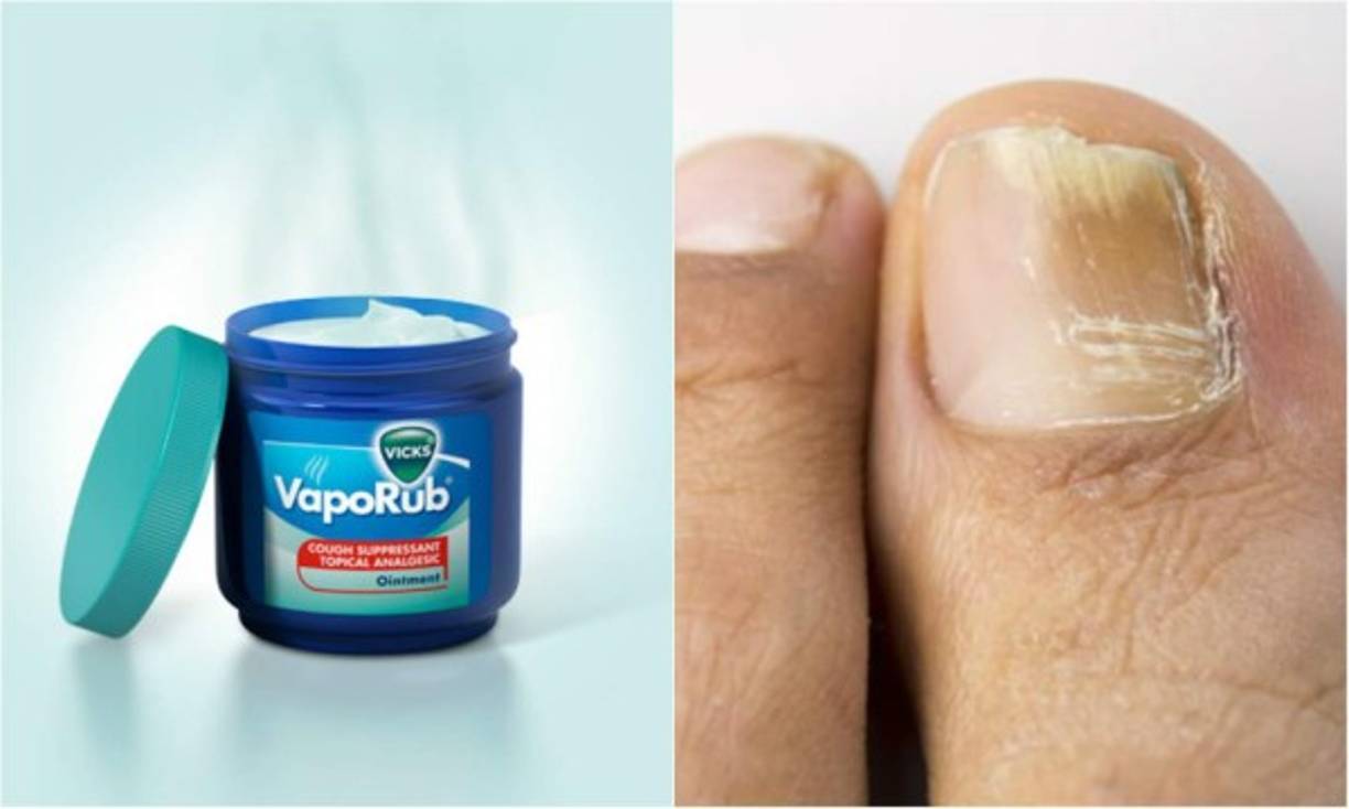 El Vicks VapoRub es un ungüento utilizado desde hace décadas para aliviar la tos y otros síntomas del resfriado común. Pero tiene otros sorprendentes usos a los que le podemos sacar mucho provecho.