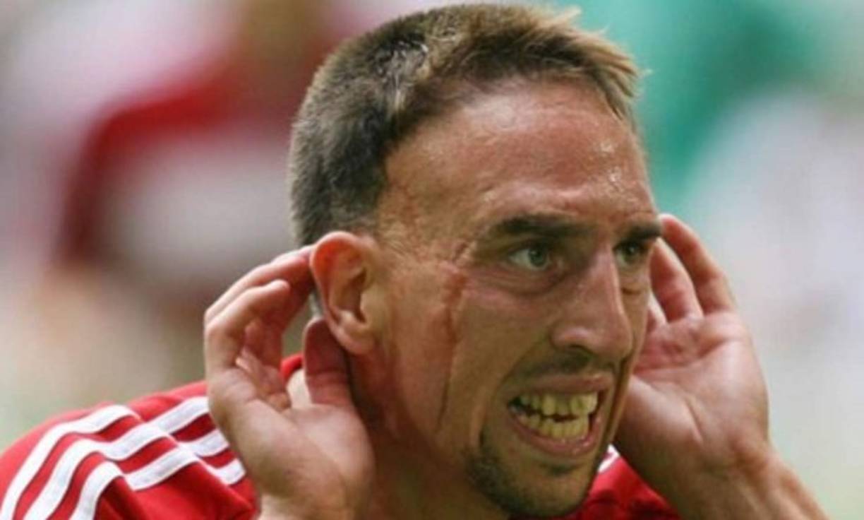 Franck Ribéry