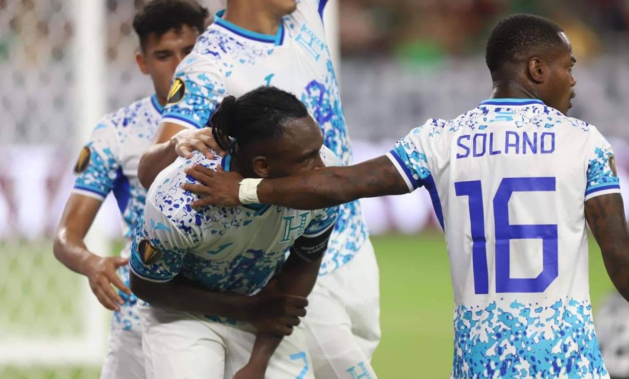 Los jugadores hondureños se preocuparon por la lesión que sufrió Alberth Elis en su brazo izquierdo.