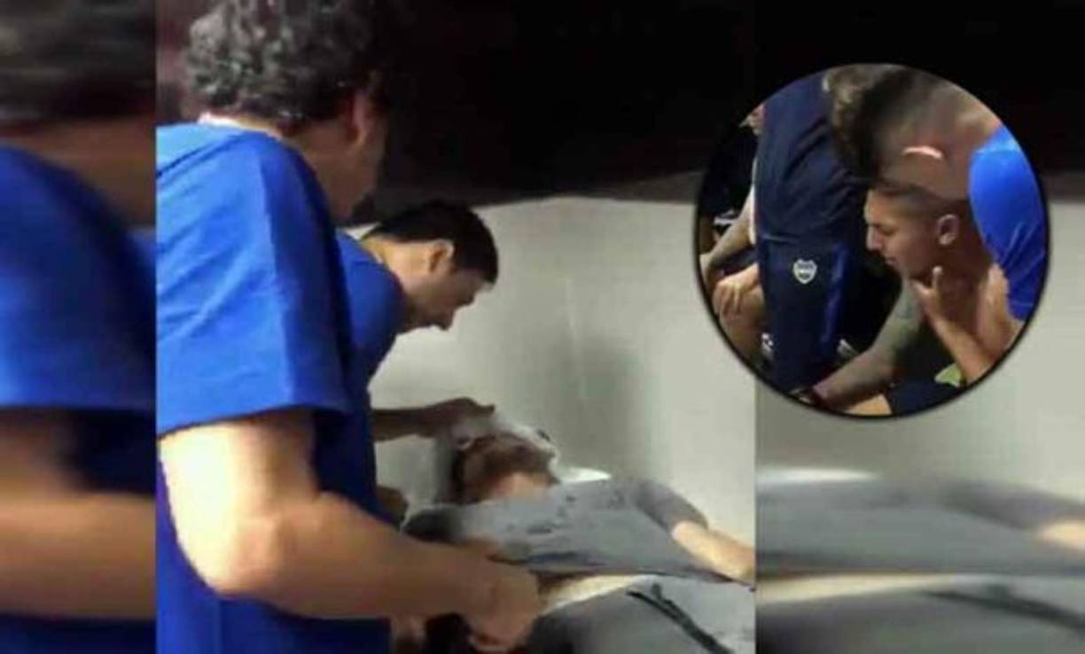 Los jugadores de Boca Juniors sufrieron terrible agresión por los seguidores de River y muchos futbolista del club xeneize quedaron con problemas tras los actos de violencia.